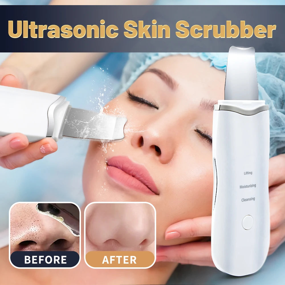 Ultrasonic Skin Scrubber Pore Cleansing Device