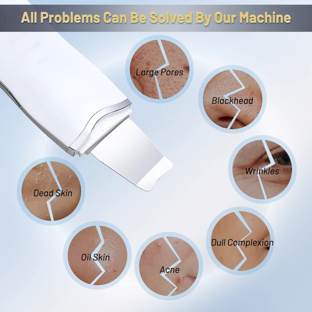 Ultrasonic Skin Scrubber Pore Cleansing Device