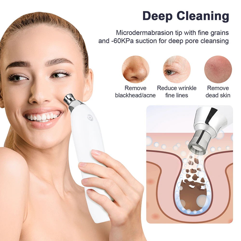 Diamond Microdermabrasion Facial Peeling Device