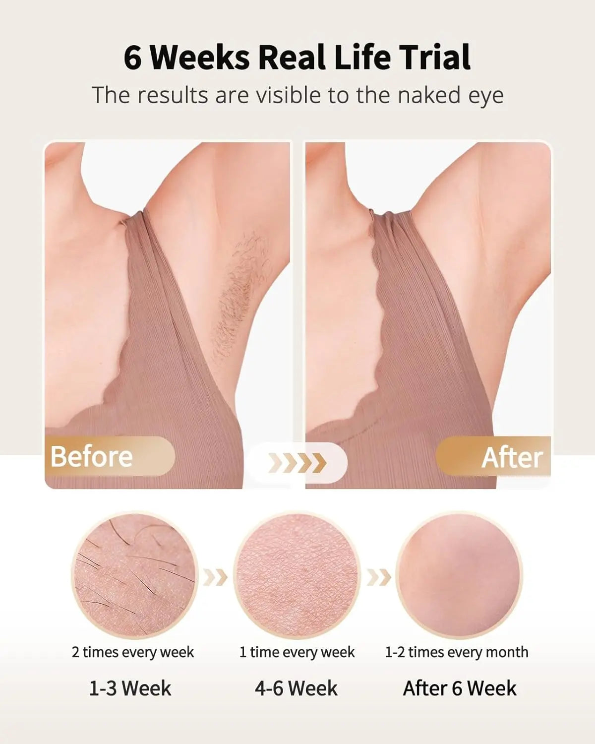 IPL Ice Cooling Laser Hair Removal Device