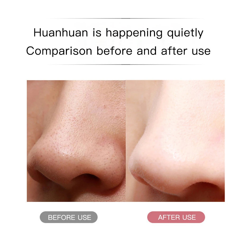 Ultrasonic Skin Scrubber Pore Cleansing Device