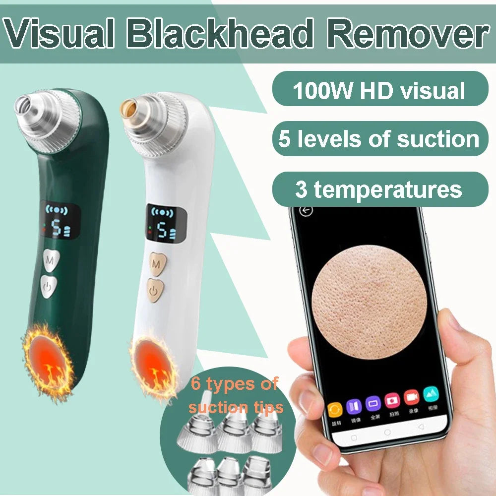 Heated Facial Blackhead Remover Suction Device